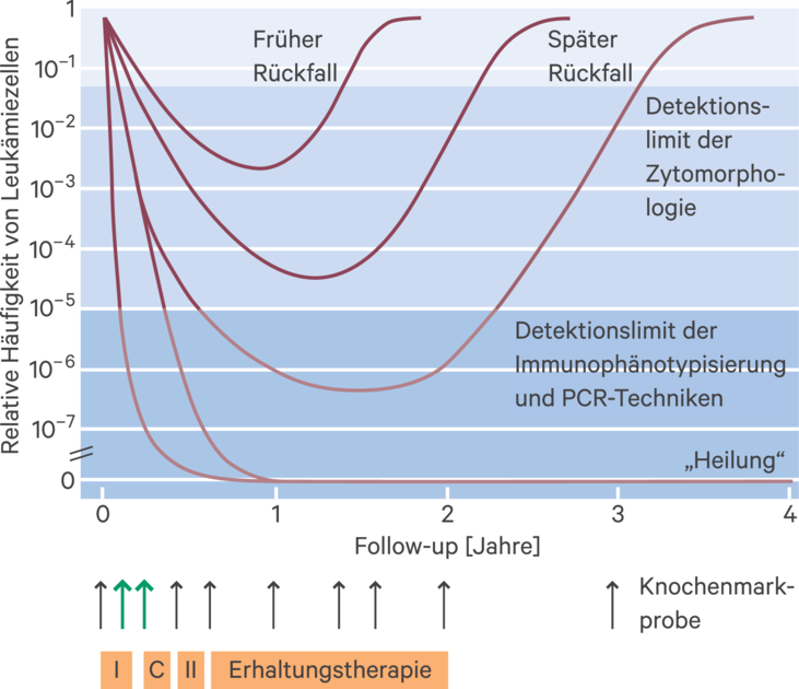Akute lymphatische Leukämie des Erwachsenen - 10 - 2017 - Heftarchiv - AMT